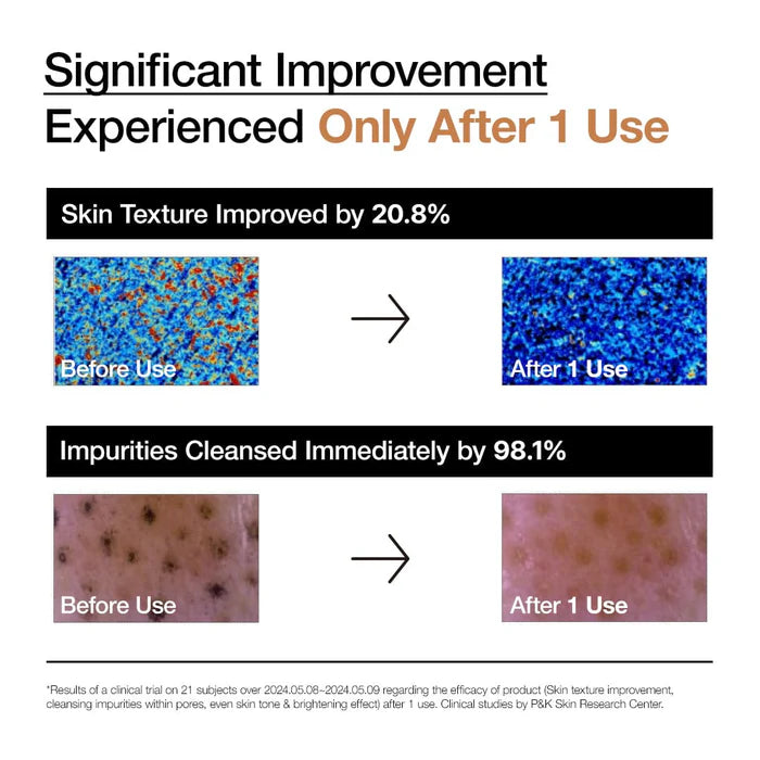 ANUA Rice Enzyme Brightening Cleansing Powder 40g Clinic Result