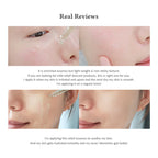 DR.ALTHEA Skin Relief Essence 30ml Reviews