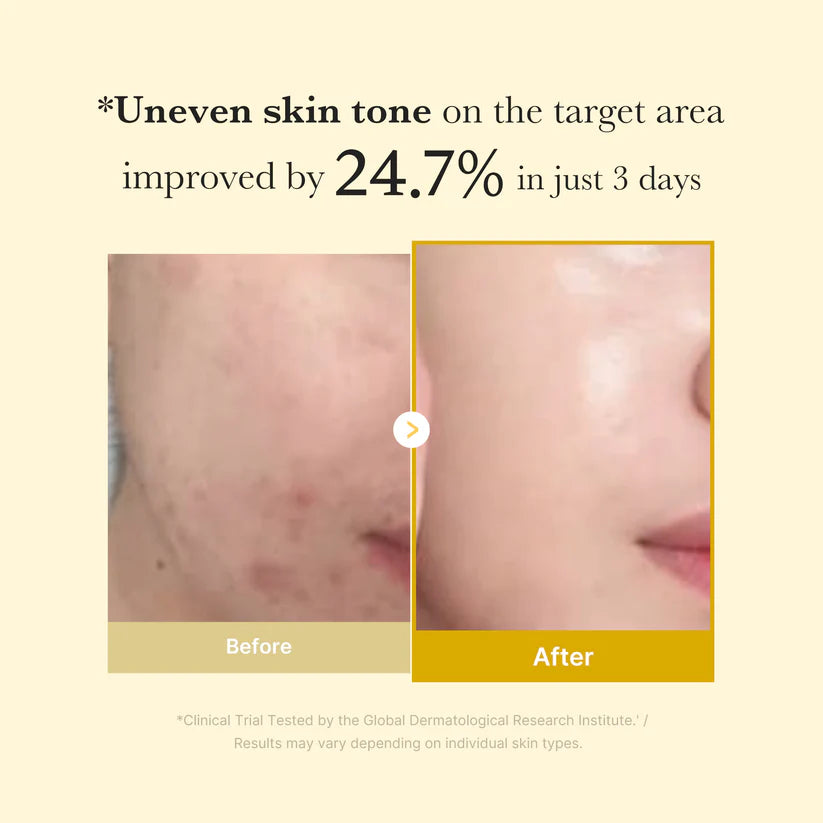 MEDICUBE Kojic Acid Turmeric Night Wrapping Mask 75ml Results