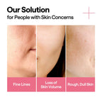 MEDIHEAL Collagen Firming Volume Serum 40ml Results