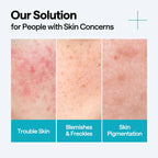 MEDIHEAL Madecassoside Repair Serum 40ml Results