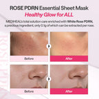 MEDIHEAL Rose PDRN Essential Mask 24ml 1 Box 10 pieces Results