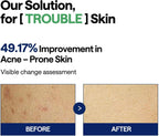 MEDIHEAL Teatree Trouble Pad 170ml 100 pads Results
