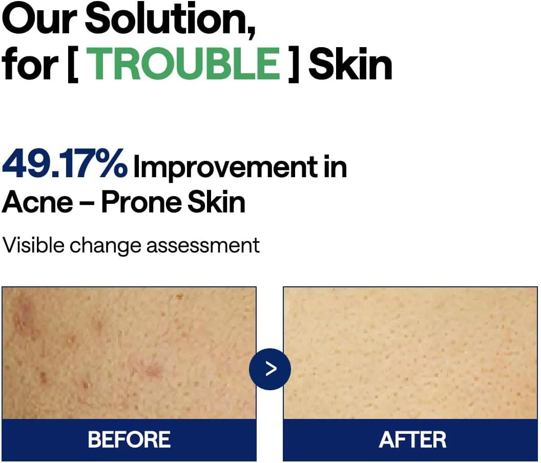 MEDIHEAL Teatree Trouble Pad 170ml 100 pads Results